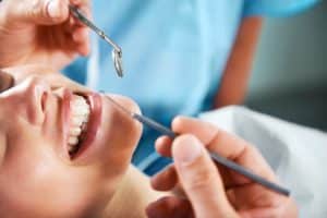 teeth-cleaning-calgary