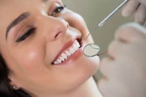 calgary-teeth-cleaning