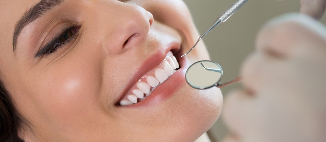 calgary-teeth-cleaning
