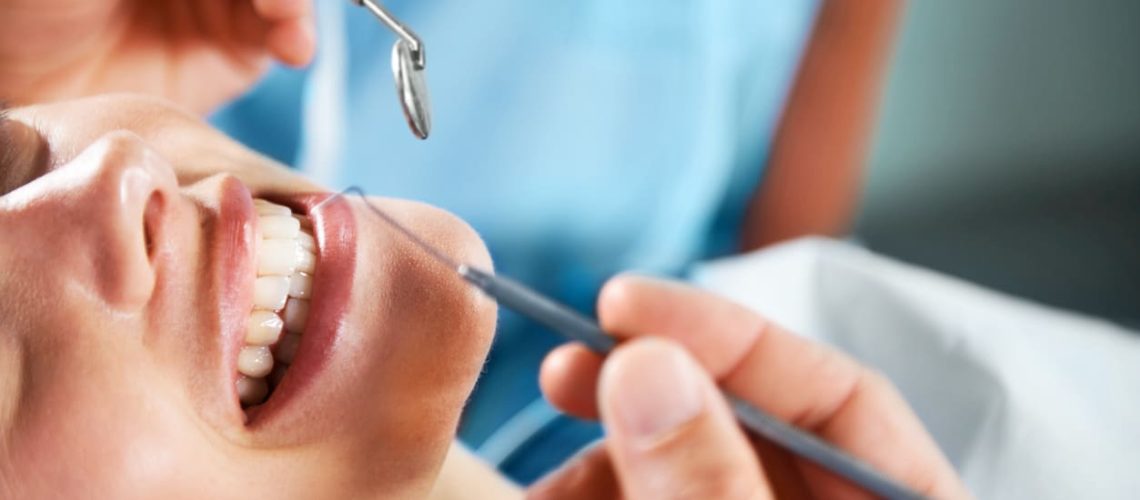 teeth-cleaning-calgary